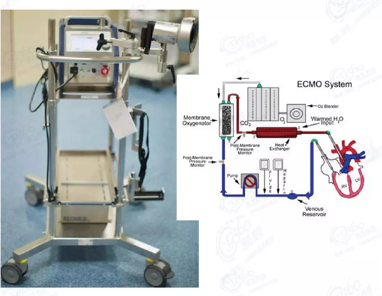 體外膜肺氧合(ECMO)設(shè)備